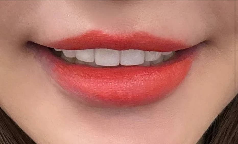 Si Ting's smile after treatment with Dr. Hosan Park